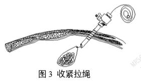 一次性使用內(nèi)窺鏡用活檢袋注冊(cè)審查指導(dǎo)原則（2025年第20號(hào)）(圖3)